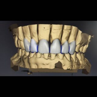https://asnaandentistry.co.za/wp-content/uploads/2025/07/IMG_20210903_205326_079-320x320.jpg